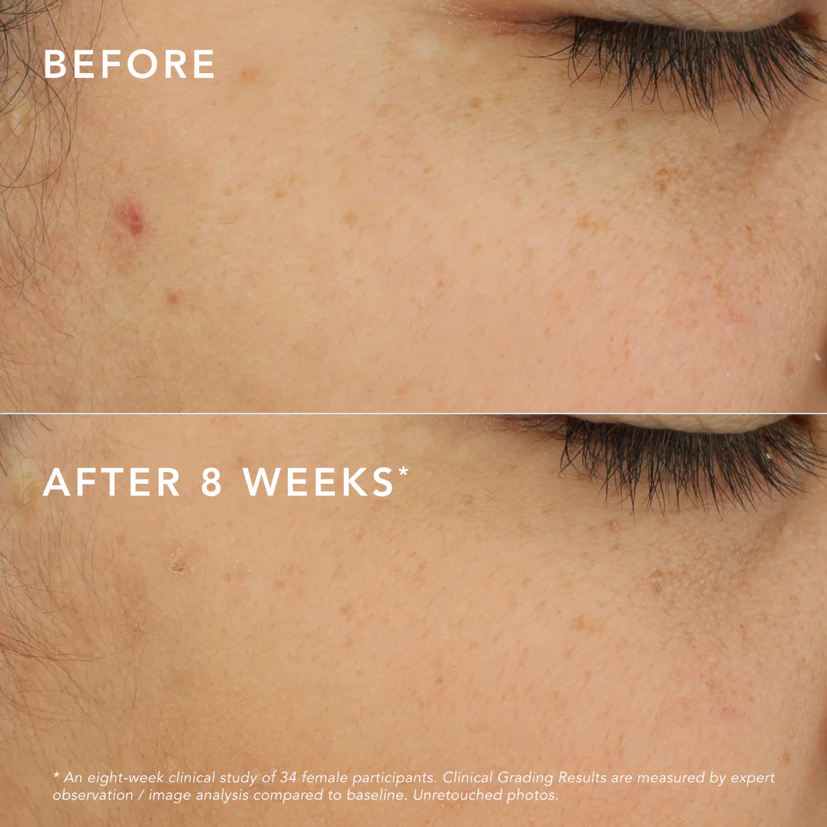 C-Bright Dark Spot Corrector - Image 6