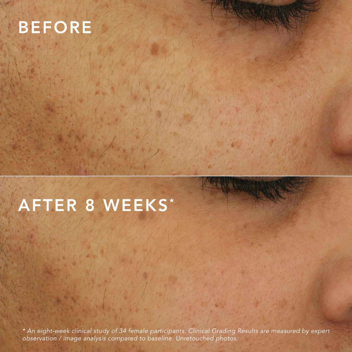 C-Bright Dark Spot Corrector - Image 7